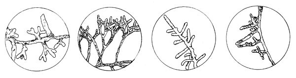 ectomycorrhizal root tips